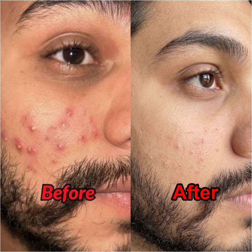 Pureza product image