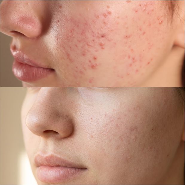 Pureza product image